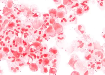 Cinco casos de meningite viral são registrados em São Luís.