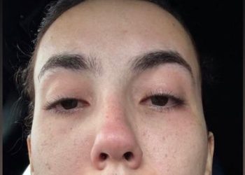 Jovem rompe acordo de sigilo e denuncia pai advogado por suposto estupro