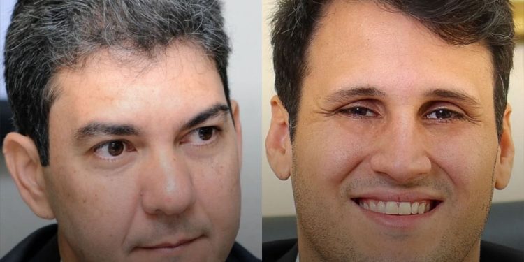 Orleans e Braide aparecem em empate técnico na disputa pelo governo do Maranhão em 2026, aponta pesquisa