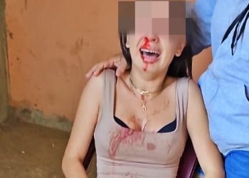 EM CAMPO MAIOR: estudante pula de carro em movimento após ter nariz quebrado por companheiro