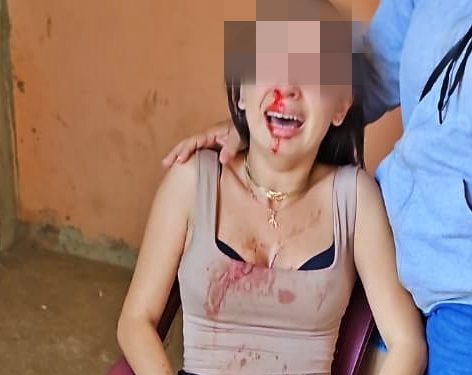 EM CAMPO MAIOR: estudante pula de carro em movimento após ter nariz quebrado por companheiro