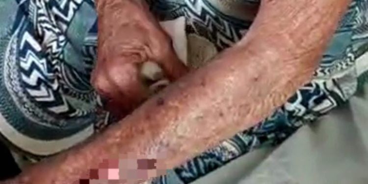 Idosa de 79 anos sofre tentativa de estupro enquanto pescava na zona rural de Codó