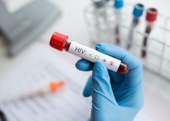 Boletim aponta alta detecção de HIV em São Luís e queda de casos de aids no Maranhão