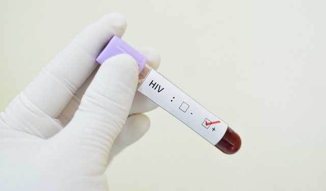 São Luís é a 3ª capital com mais registros de HIV e Aids, mas diagnóstico não é sentença de morte