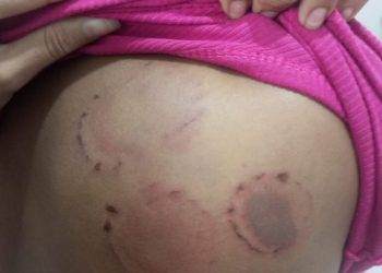 Em Pinheiro, homem é preso acusado de agredir a namorada com socos e mordidas