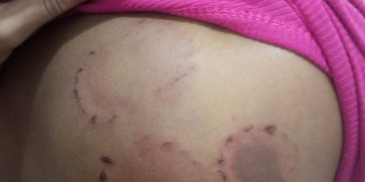 Em Pinheiro, homem é preso acusado de agredir a namorada com socos e mordidas